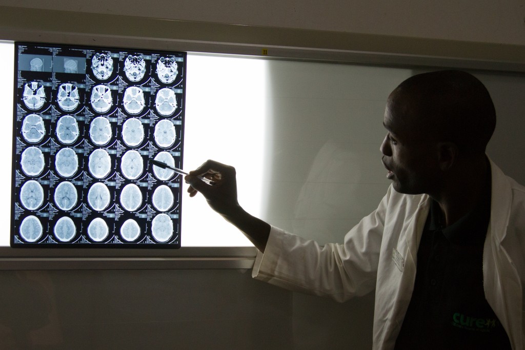 Výsledky CT naznačujú vážne poškodenie mozgu.